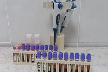 За два месяца более тысячи новорожденных прошли неонатальный скрининг по новой программе За два месяца более тысячи новорожденных прошли неонатальный скрининг по новой программе